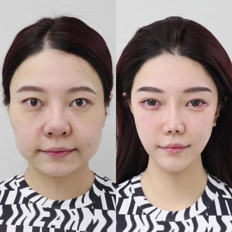 皮肤美容