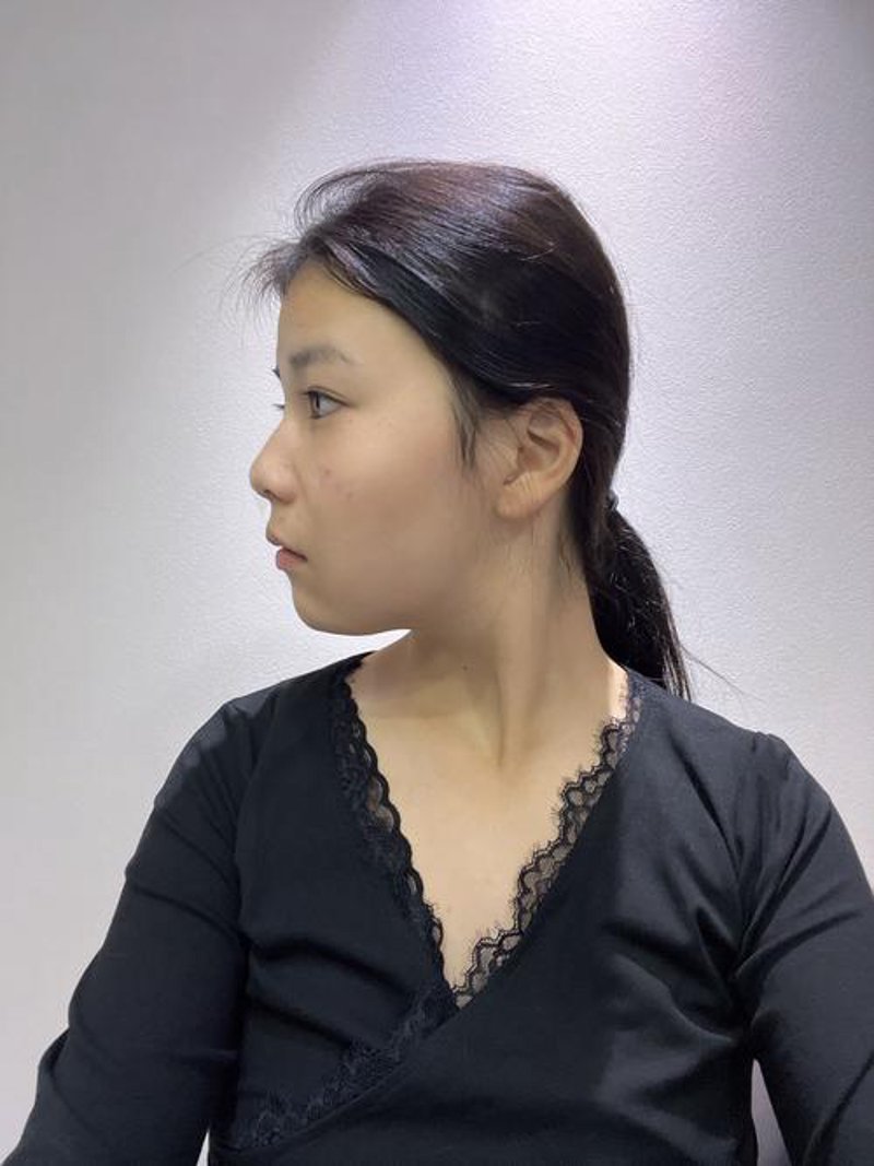 新疆整形美容行业动态：天山区引领新潮流