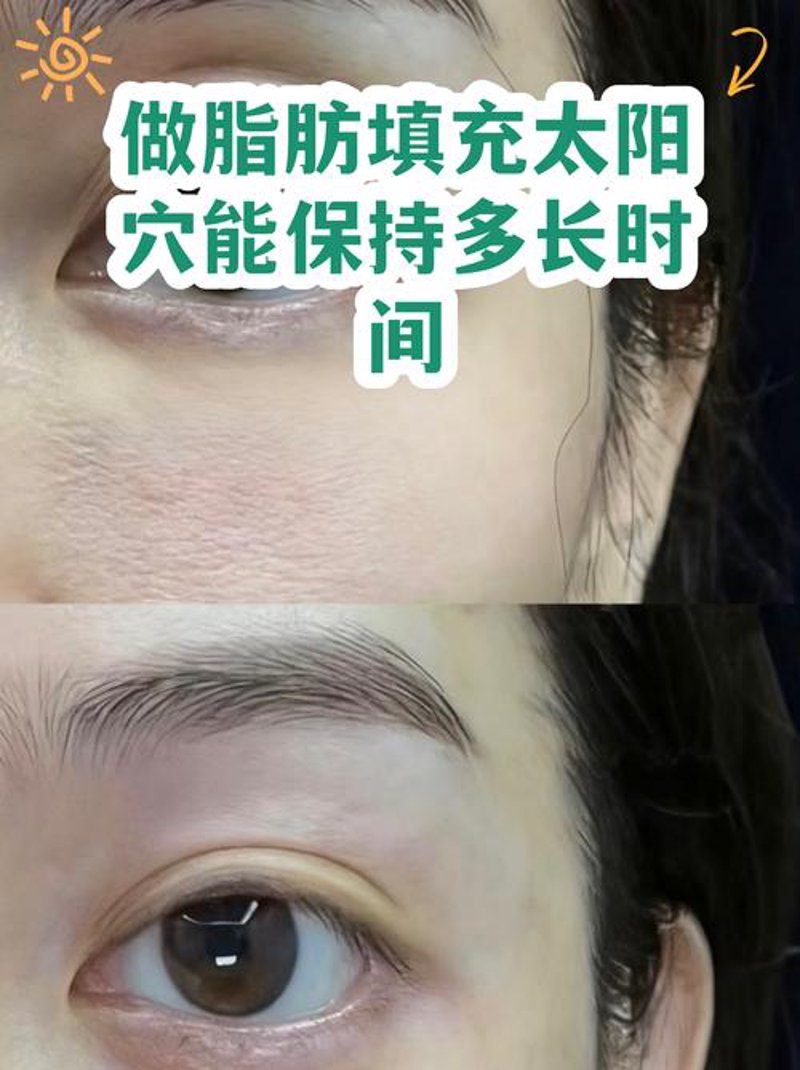 走进乌鲁木齐微整形市场：变化与趋势