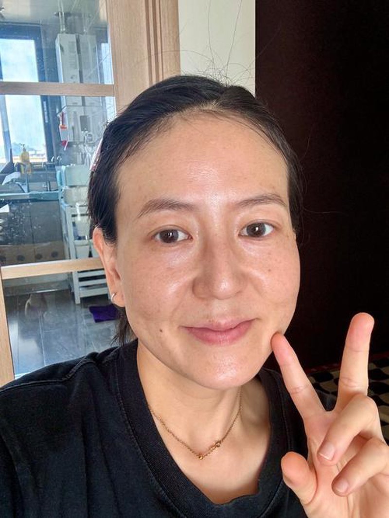 美丽触手可及：天山区医美行业的变化与趋势