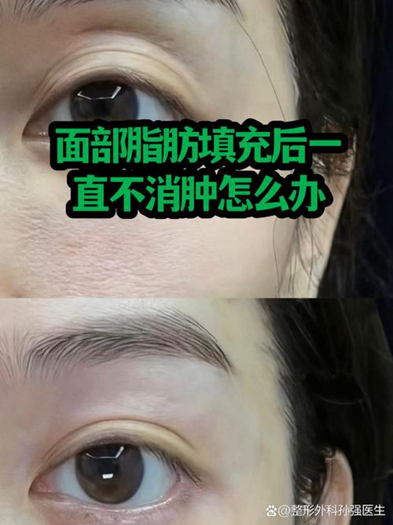 世纪亚太整形美容：引领潮流的新风尚